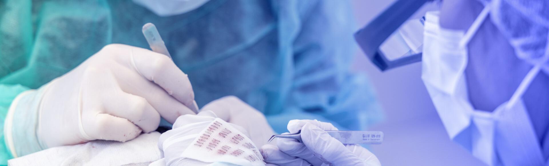 Haartransplantatie technicus aan het werk bij HCI Clinics