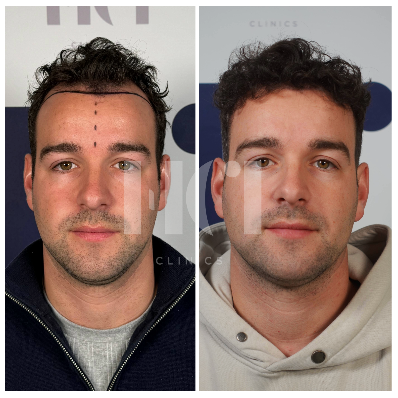 Before / After